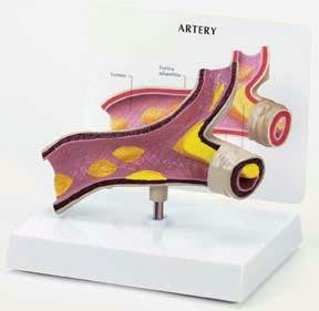 Artery Model